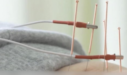 针灸视频,入门到精通的实用指南