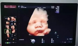 四维视频,四维视频揭秘未知世界